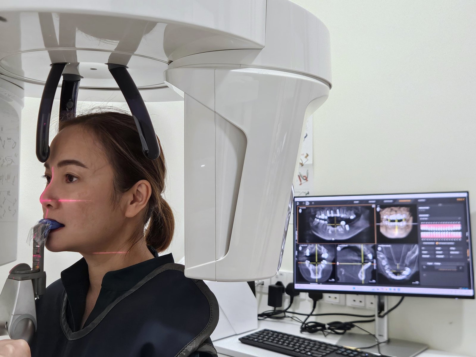 A CBCT scan being taken at Calm Dental: the positioning lasers line the head up, a lead apron covers the chest, and the completed scan is reviewed on the screen alongside