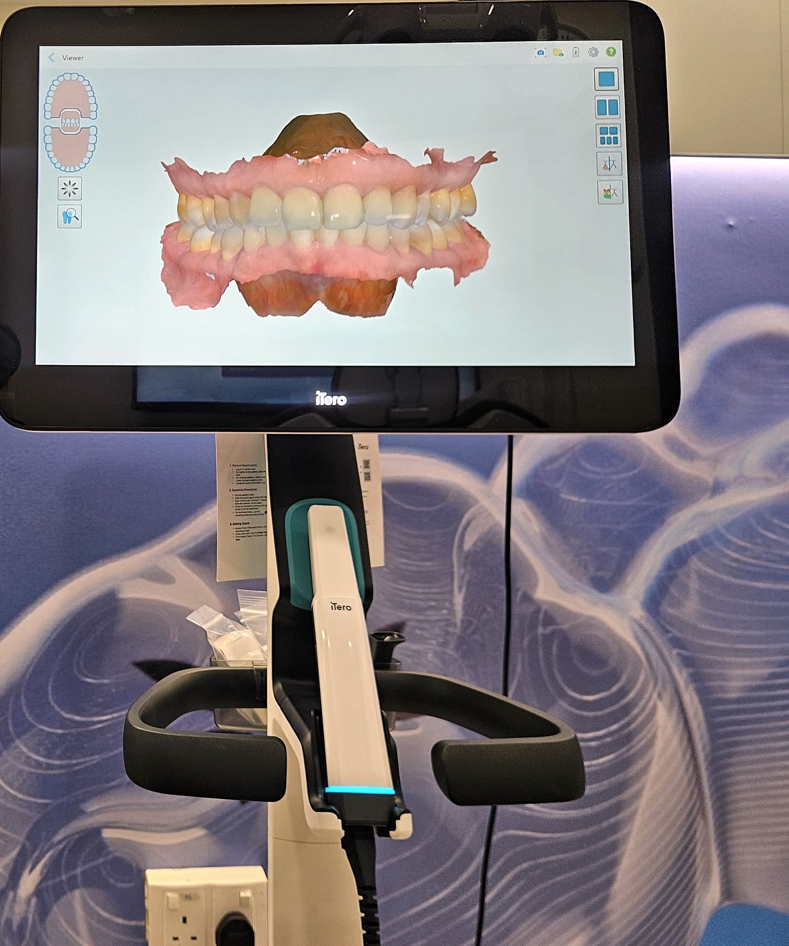 The iTero digital scanner at Calm Dental, Millenia Walk, showing a 3D scan on screen