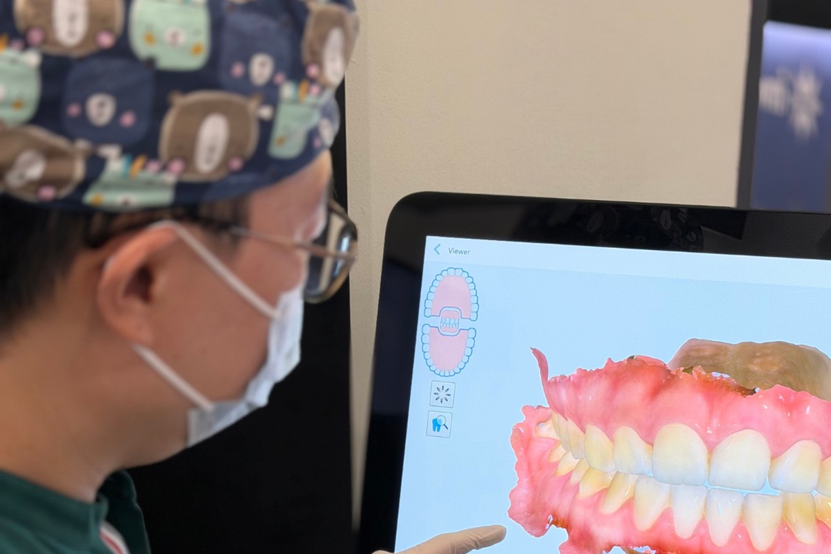 A dentist at Calm Dental reviewing a patient&rsquo;s 3D intraoral scan on the iTero screen